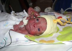 Elias vägde 660 gram